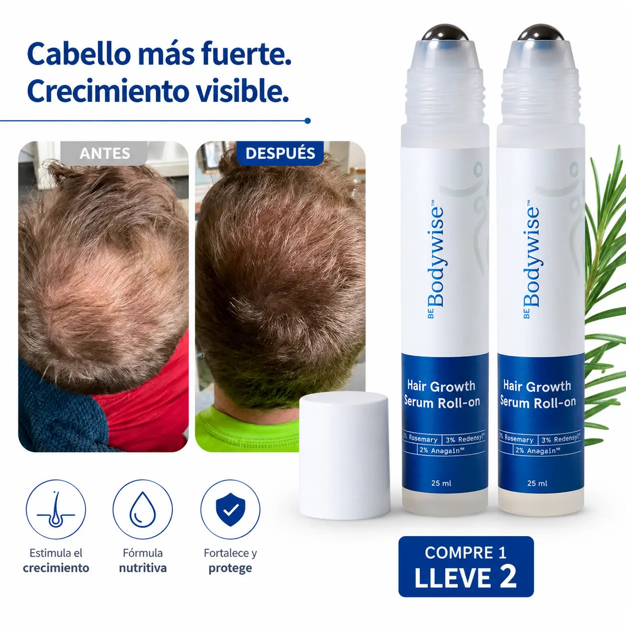 BodyWise ™  Sérum Capilar Anticaída y Crecimiento Intensivo [Nutre, fortalece y estimula]